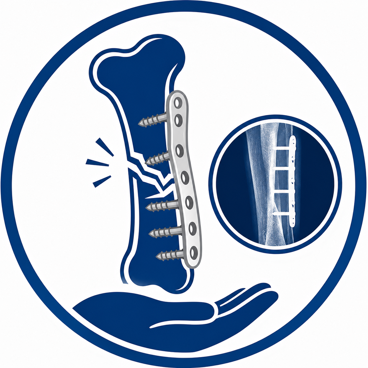 Fracture Care & Reconstruction