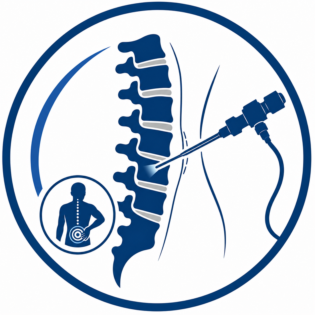Minimally Invasive Spine Surgery